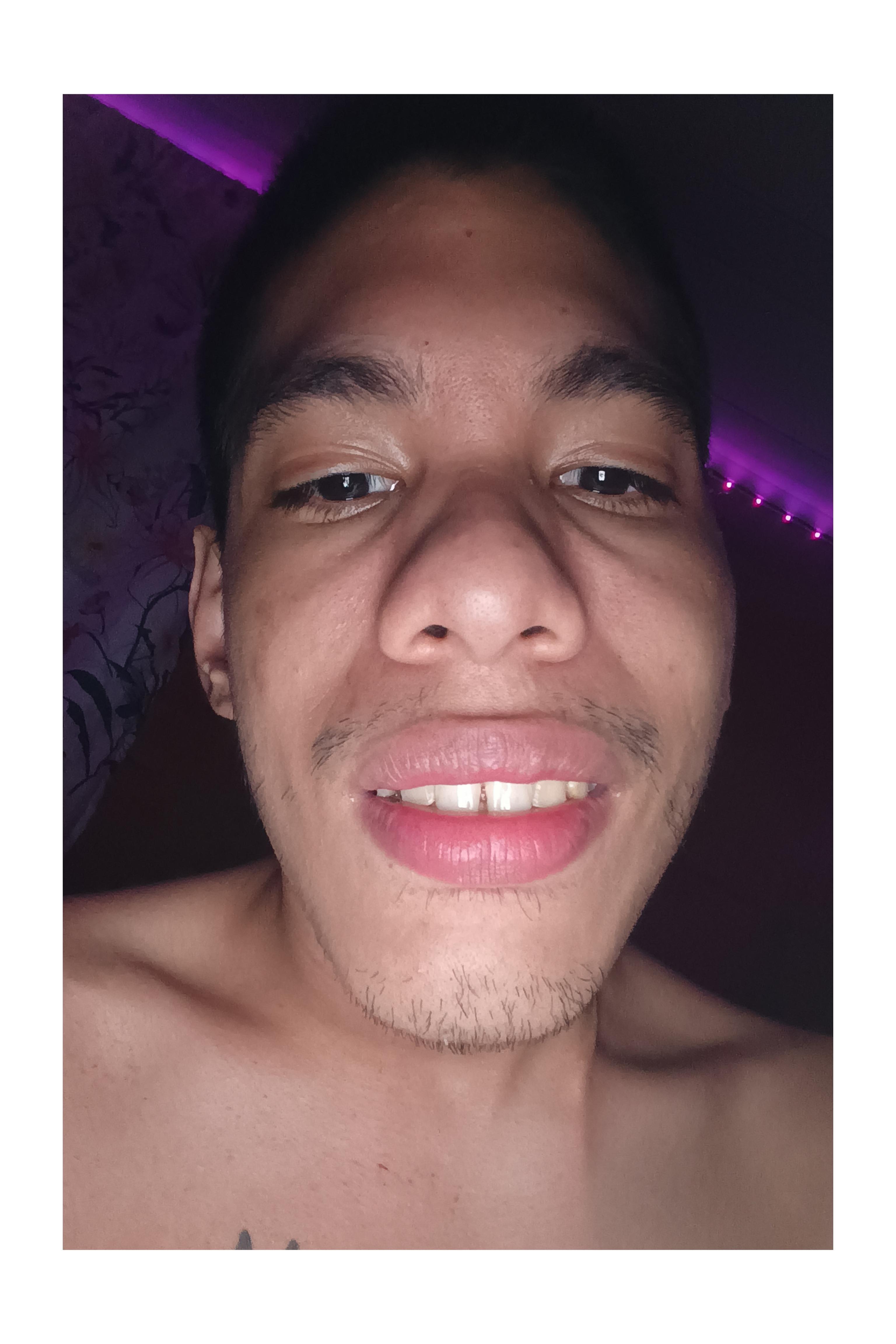 Nea800 from Colombia